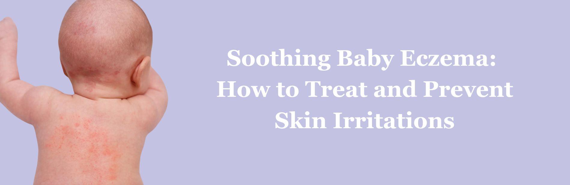 Soothe Your Baby's Eczema: Top Creams & Treatment Tips – Omumsie